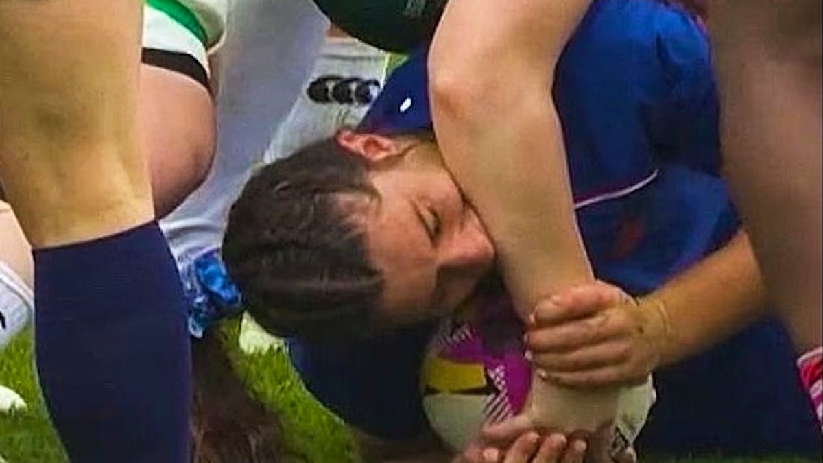 A French player bites her opponent in the middle of the World Cup