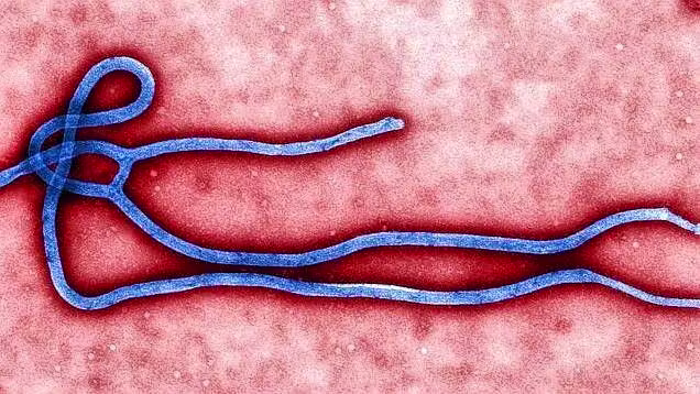 Ebola: placement in solitary confinement for two suspected cases