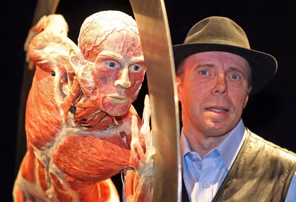 The one who caused a scandal with the plastinated bodies has died